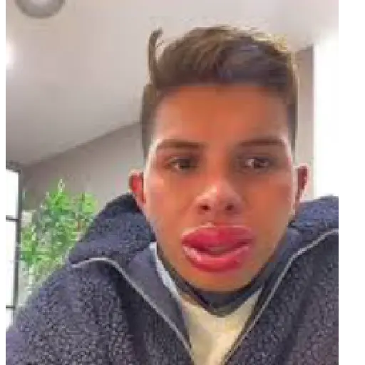 Emiro navarro 7